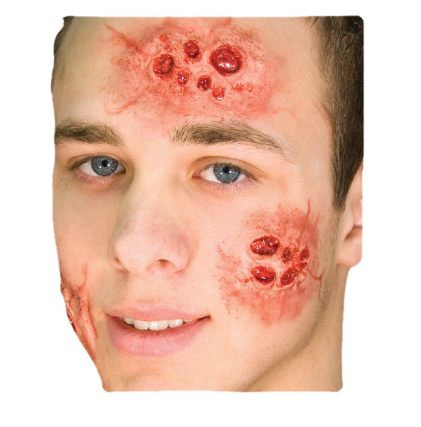 Morning After Prosthetic Application