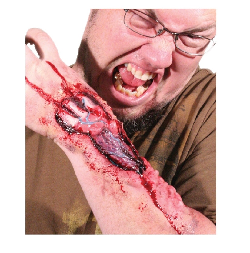 Eaten Away Prosthetic Application