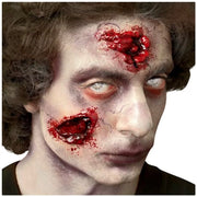 Fester Prosthetic Application