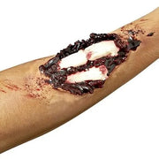 Compound Fracture Application