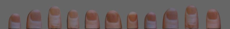 Vernet Thumb Tip